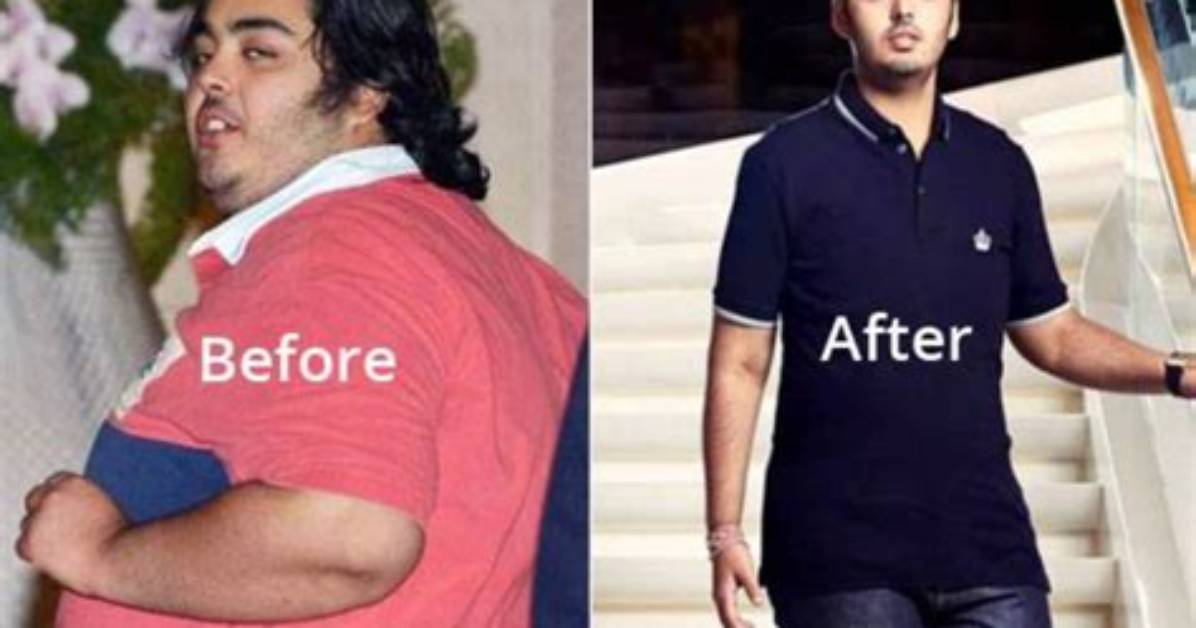 Anant Ambani's Weight Loss Journey: Unveiling the Obese Past