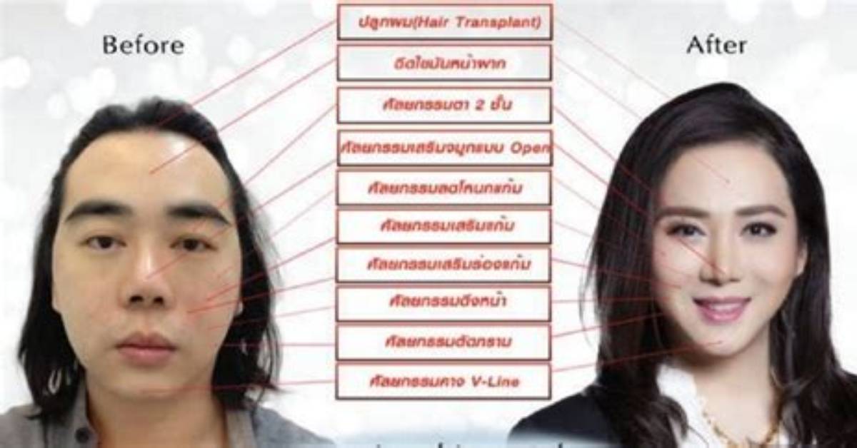 Anne Jakrajutatip Before Surgery Pics, Age Height and Instagram
