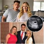 Breaking News: Brittany Mahomes Announces Pregnancy