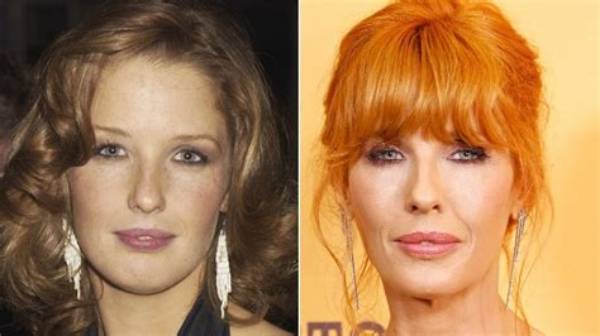 Did Kelly Reilly Get Lips Surgery? Before and After Photos
