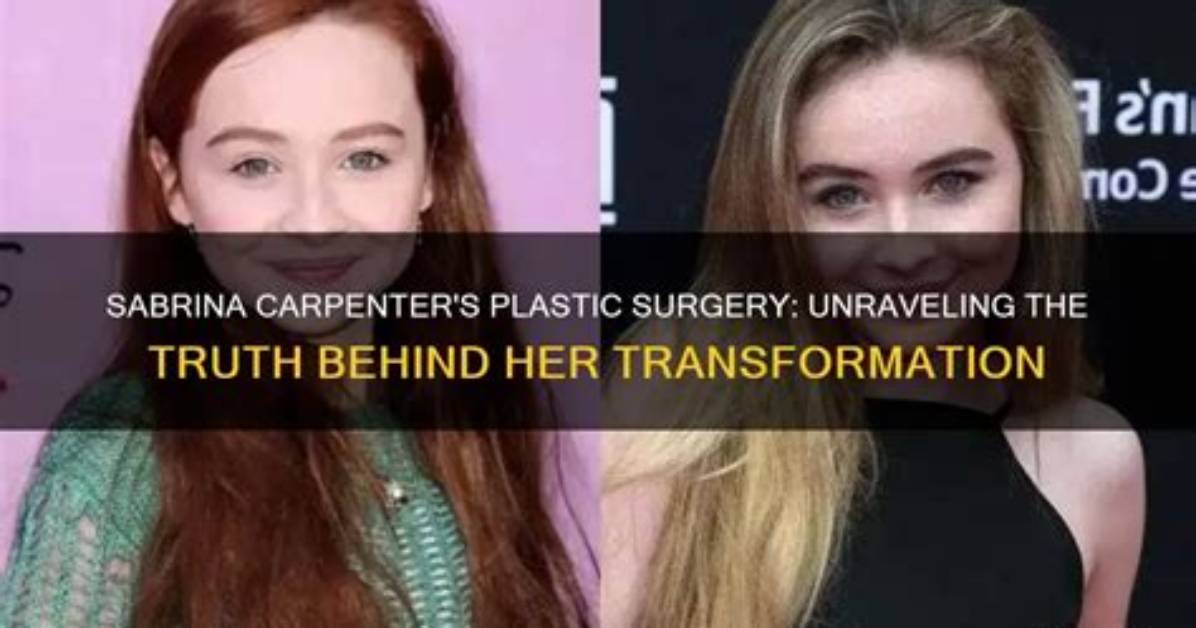 Did Sabrina Get Plastic Surgery: the Truth Revealed