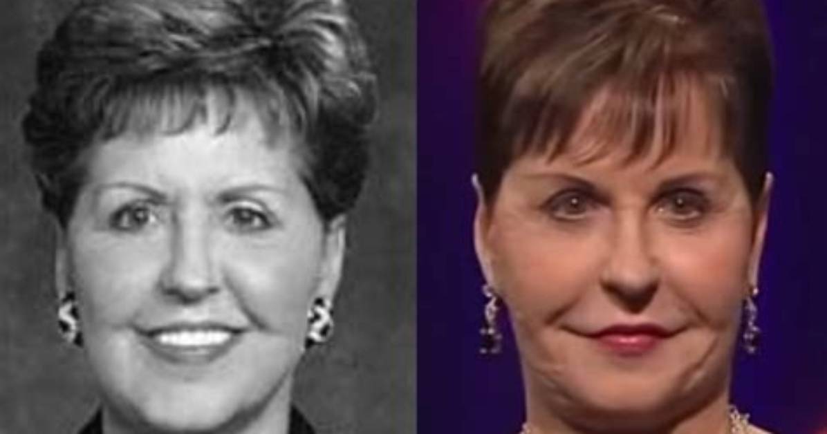Discover the Joyce Meyer Face Lift
