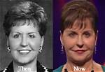Discover the Joyce Meyer Face Lift