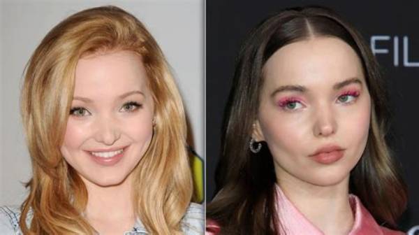Dove Cameron Weight Loss Reason; Before and After Photos