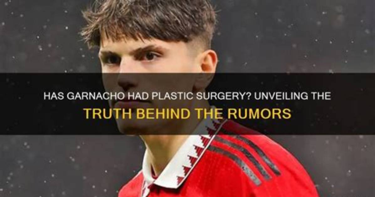 Exploring Garnacho Plastic Surgery: Facts and Speculations