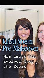 Exploring Kristi Noem's Cosmetic Journey