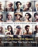 Famous Faces with Noonan Syndrome