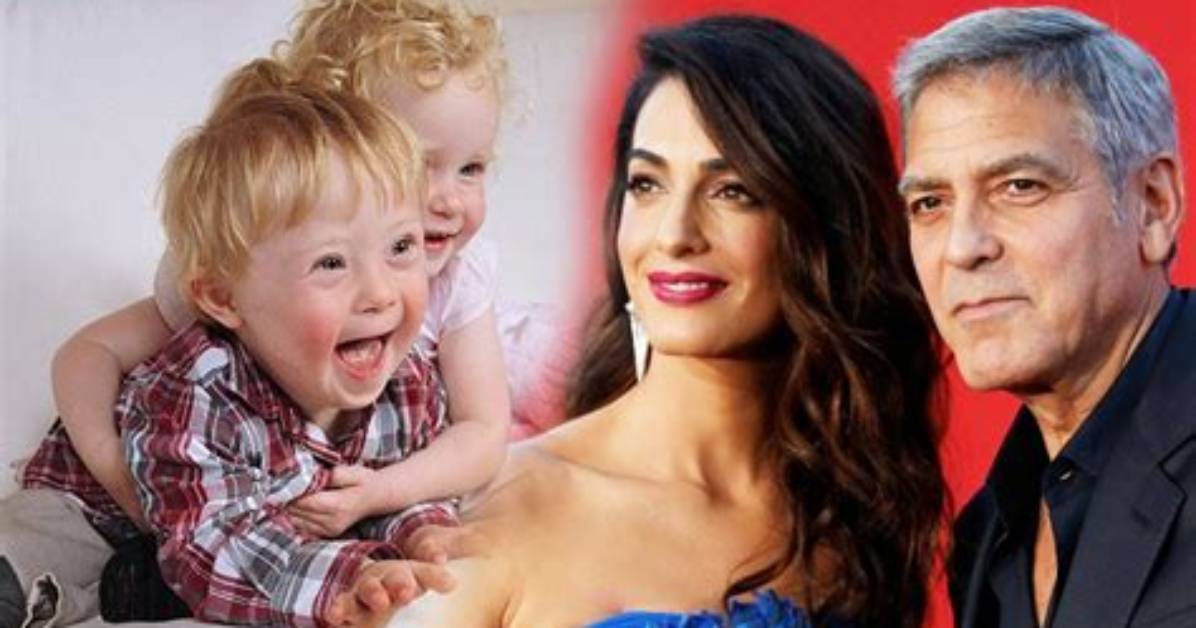 George Clooney's Child and Down Syndrome: Unraveling the Truth