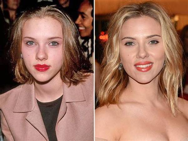 Has Scarlett Johansson Had Plastic Surgery? Truth Revealed Here