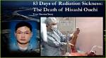 Hisashi Ouchi: a Tragic Tale of Nuclear Accident and Endurance