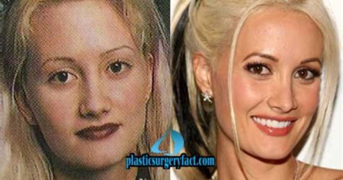 Holly Madison's Transformation: a Comparison of Before and After