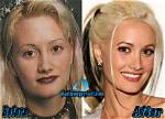 Holly Madison's Transformation: a Comparison of Before and After