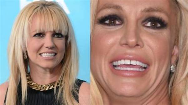 Is Britney Spears on Meth, What Happened to Her Teeth? Addiction and Condition