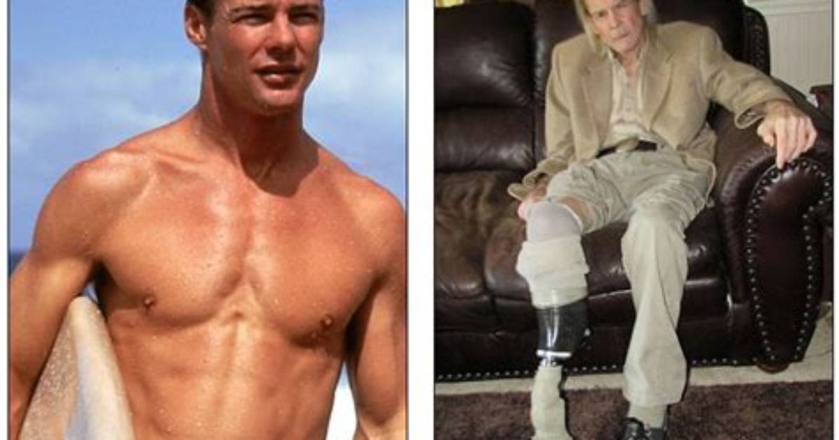 Jan Michael Vincent's Leg Amputation Journey