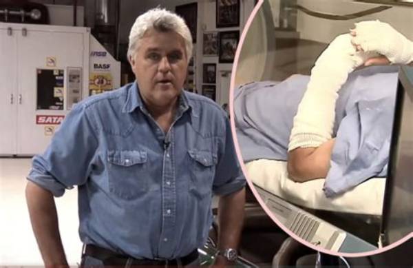 Jay Leno Stated That He Is Recovering Well After Being Injured in a Fire Incident