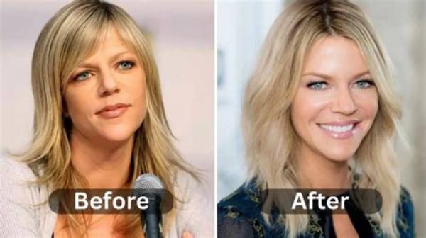 Kaitlin Olson Plastic Surgery as Dee from Always Sunny