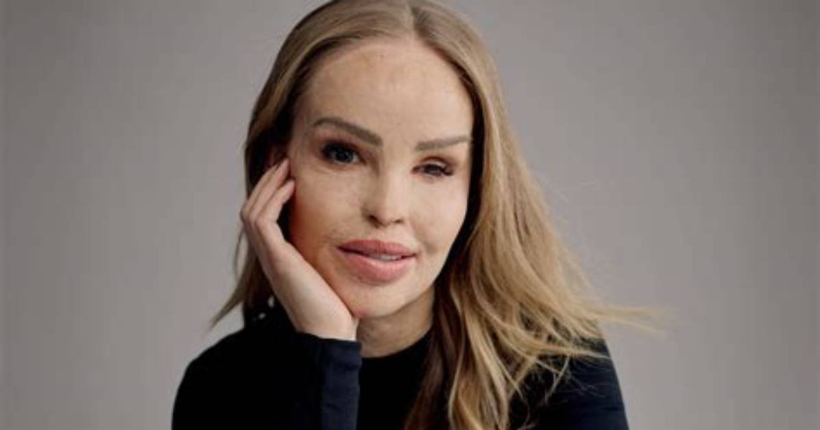 Katie Piper Height, Weight, Net Worth, Age, Birthday, Wikipedia, Who, Nationality, Biography