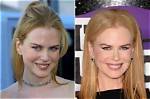 Kidman's Surgery: Details Unveiled