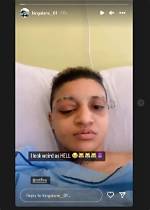 King Alami Accident, What Happened to King Alami?