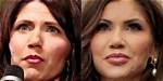 Kristi Noem's Alleged Plastic Surgery Journey