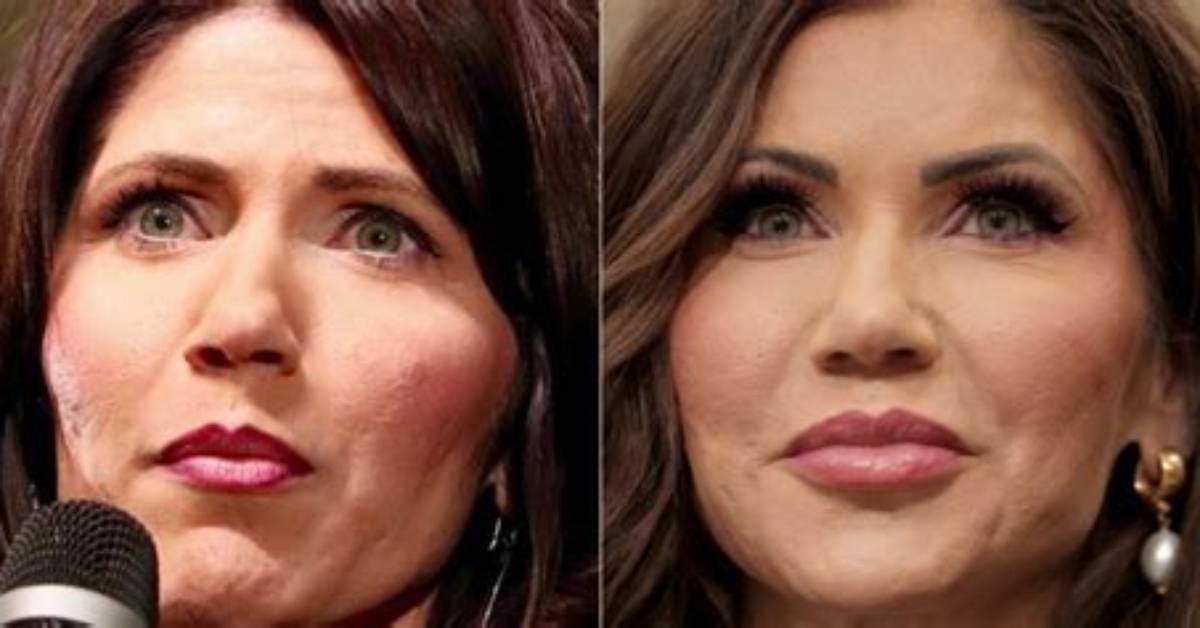 Kristi Noem's Cosmetic Surgery Journey Unraveled