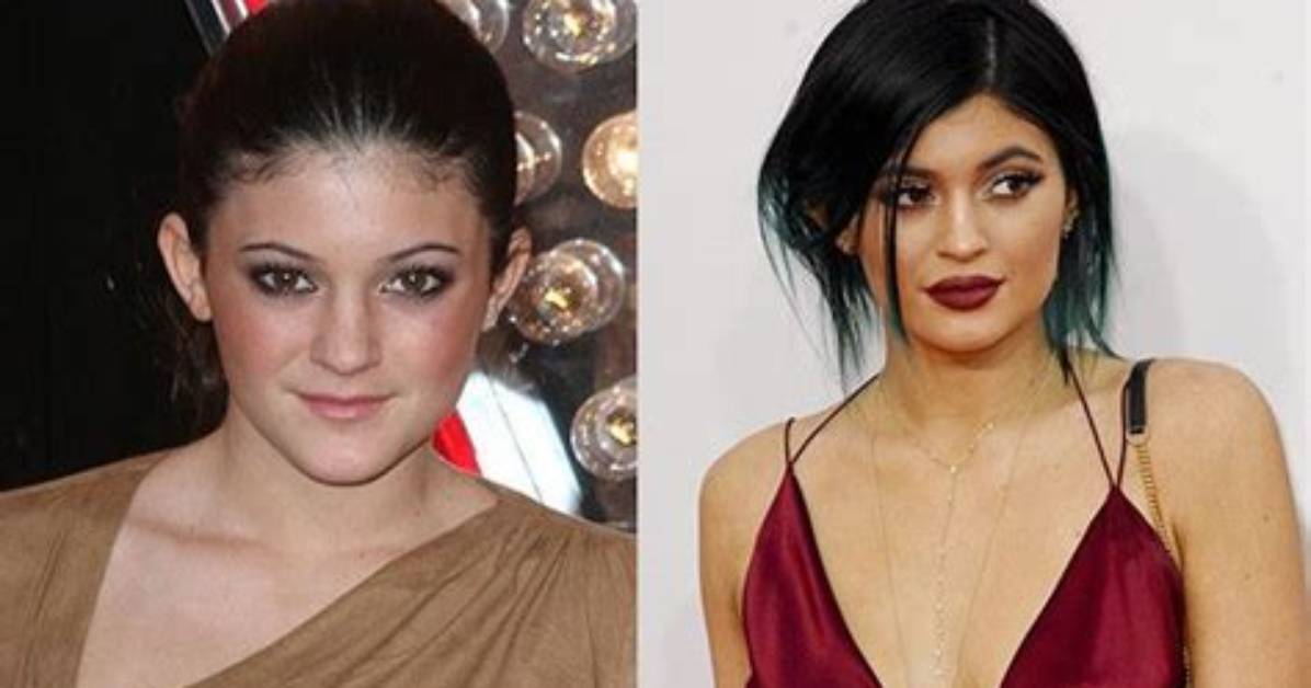 Kylie Jenner's Incredible Transformation: Weight Loss Journey Explored