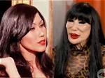Lyn May and Her Journey with Botox: a Tale of Transformation