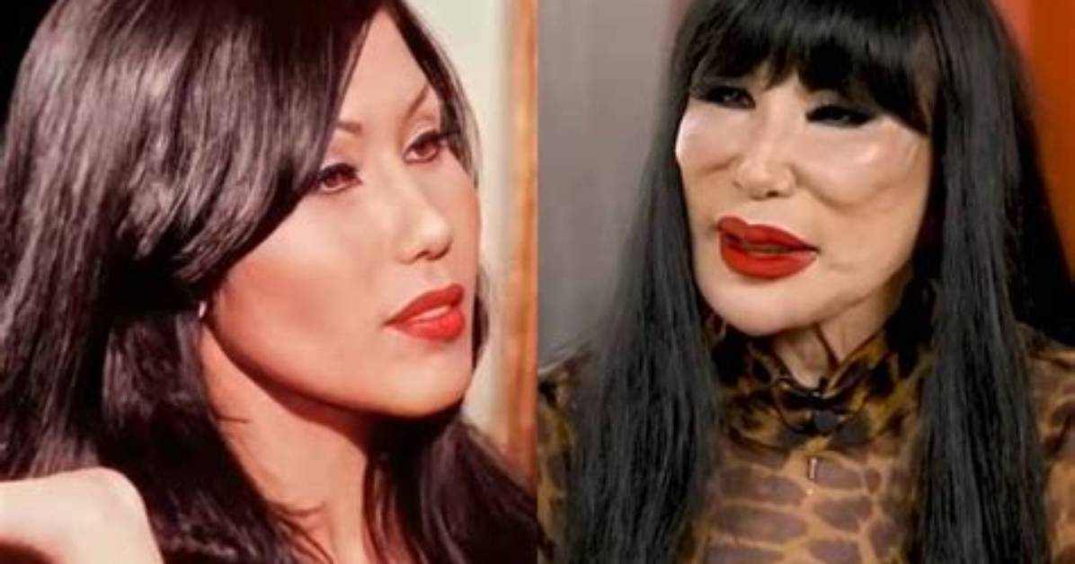 Lyn May: What Happened to the Iconic Star?