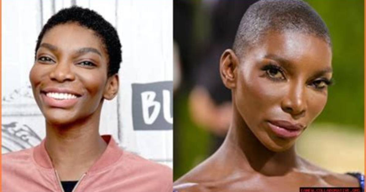 Michaela Coel's Journey: Exploring Fibroids and Recovery