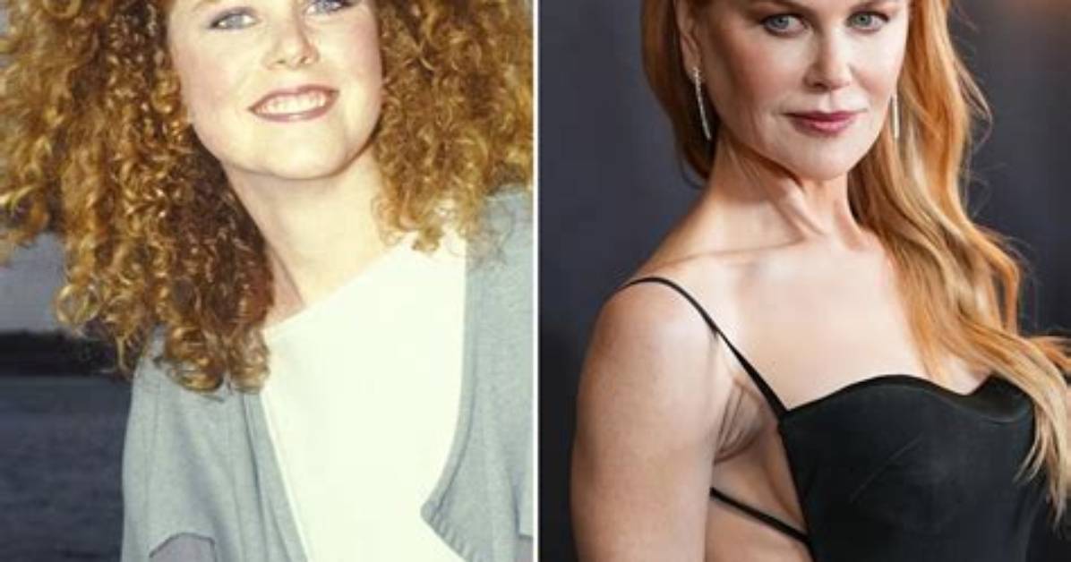 Nicole Kidman's Transformation: Before and After Surgery