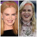 Nicole Kidman Surgery: a Closer Look at the Hollywood Star's Transformation