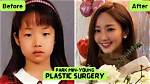 Park Min Young's Transformation: Before and After Surgery