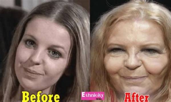 Sally Thomsett Face Surgery & Before After Pictures, Does She Also Have an Illness?