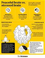 Stress, the Brain, and Beyond