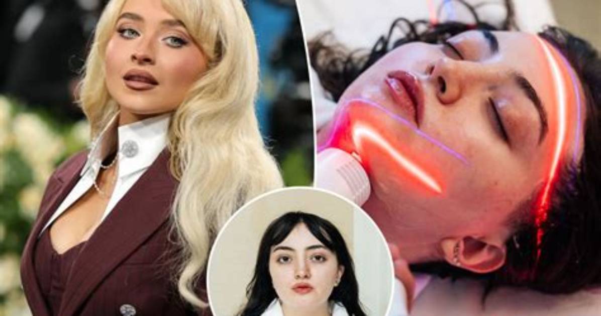 The Truth Behind Sabrina Carpenter's Facial Transformation