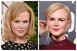 The Truth Revealed: Has Nicole Kidman Undergone Plastic Surgery?