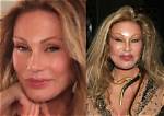 The Unbelievable Transformation of Jocelyn Wildenstein: the 'Cat Lady'