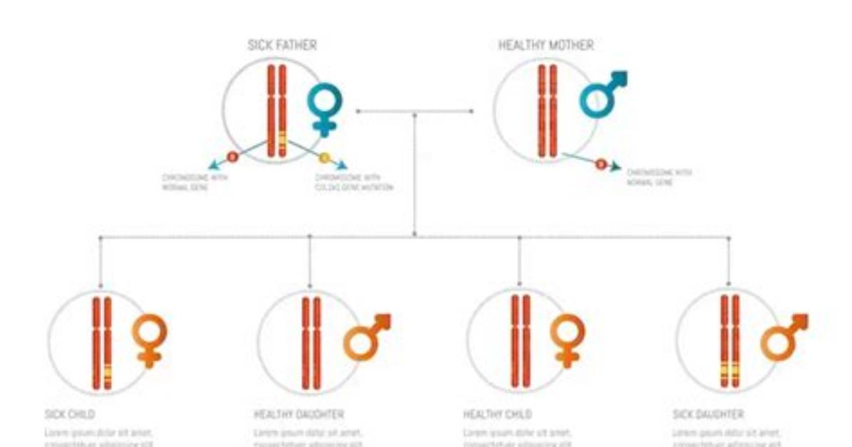 Understanding Fletcher's Syndrome: a Comprehensive Guide