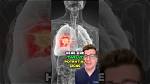 Understanding the Menthol Feeling in Chest: Causes and Effects