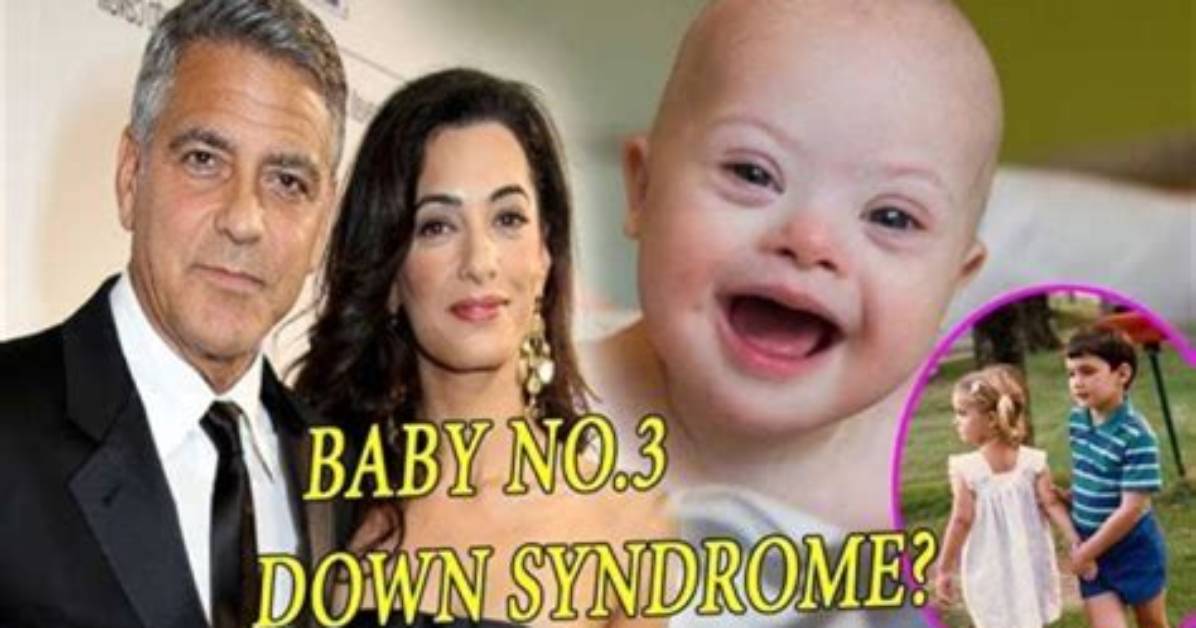Understanding the Truth: Does George Clooney's Son Have Down's Syndrome?