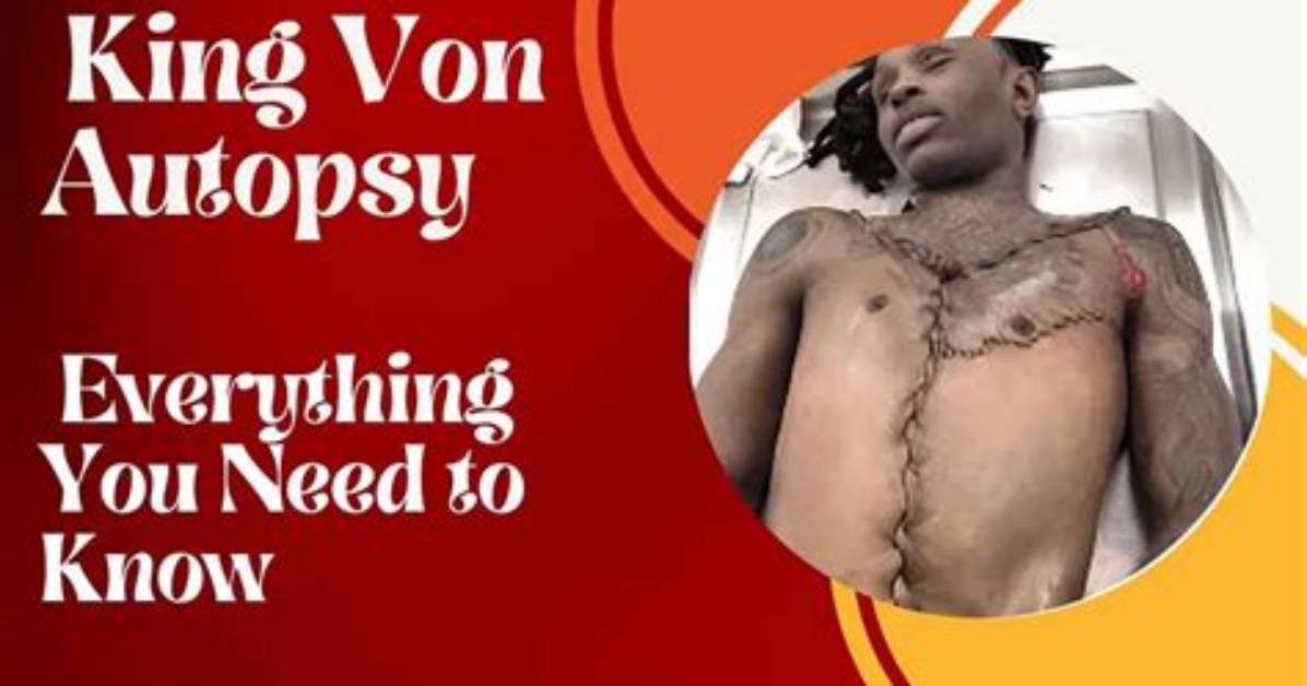 Unraveling the Mystery: King Von Autopsy Full Details
