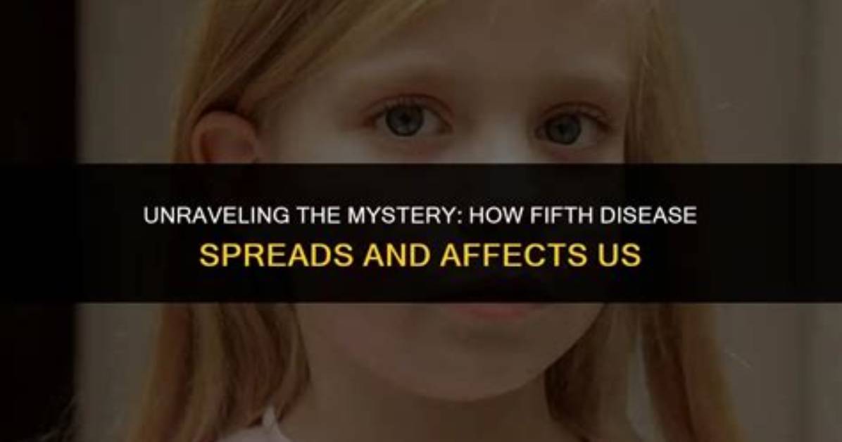 Unraveling the Mystery: What Disease Does Shannon Bream Have?