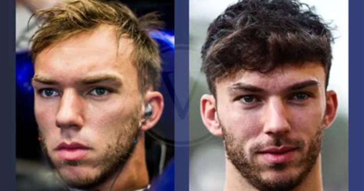 Unravelling Pierre Gasly's Hair Transplant Journey