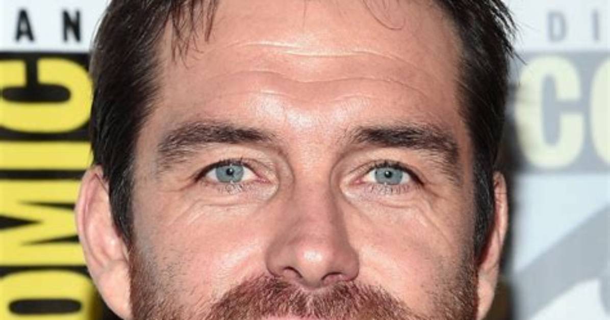 Unveiling Antony Starr: the Truth Behind His Plastic Surgery Rumors