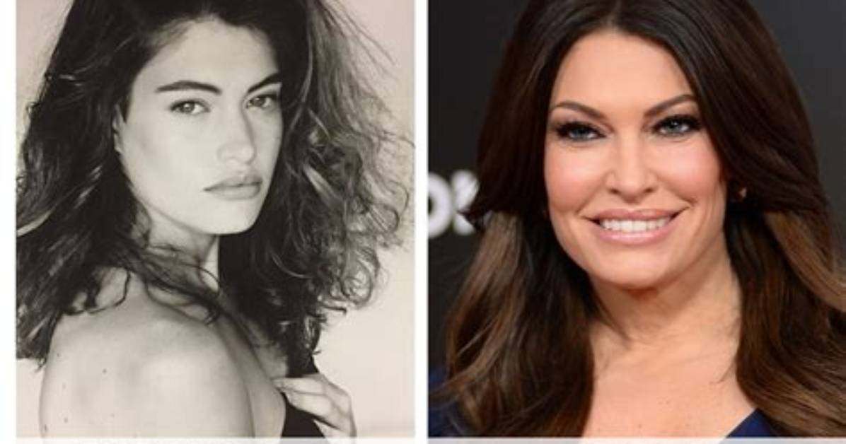 Unveiling Kimberly Guilfoyle's Transformation: Before and After Revealed
