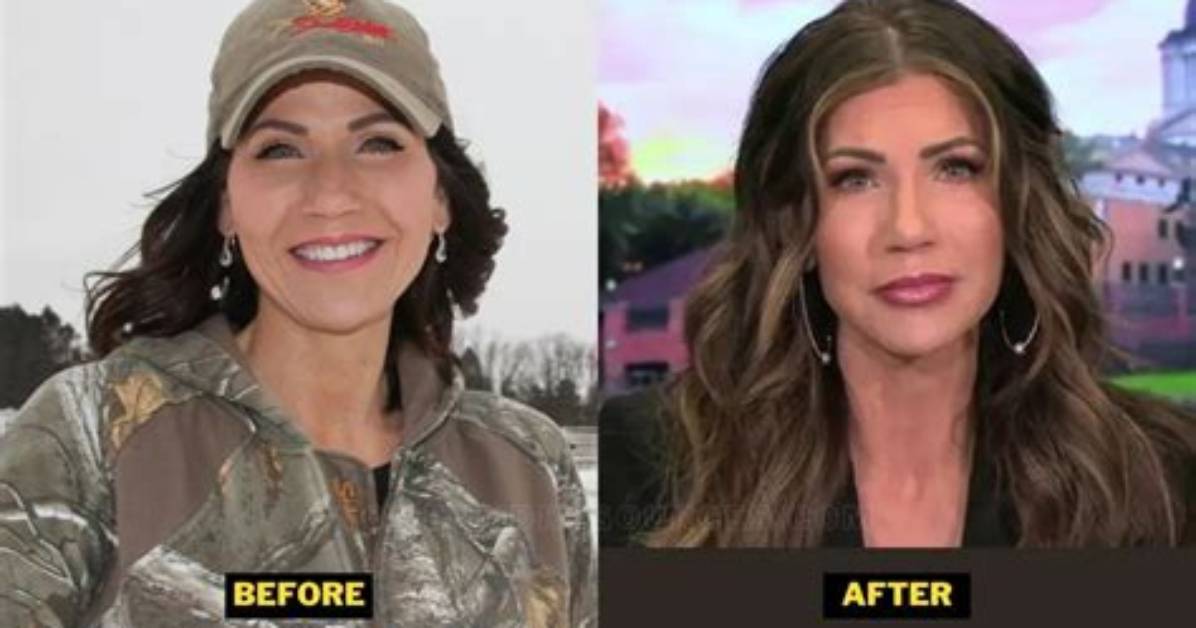 Unveiling Kristi Noem's Remarkable Transformation: an Analysis of Her Changing Appearance