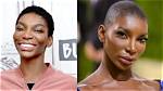 Unveiling Michaela Coel's Plastic Surgery Journey: Discoveries and Insights