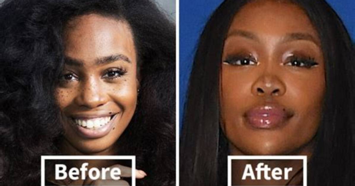 Unveiling Sza's Transformation: the Pre-Surgery Saga