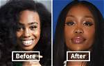 Unveiling Sza's Transformation: the Pre-Surgery Saga