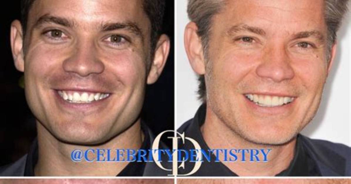 Unveiling the Charm: Timothy Olyphant's Teeth